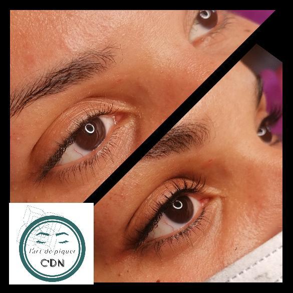 RAS DE CIL OU INFRA CILIAIRE