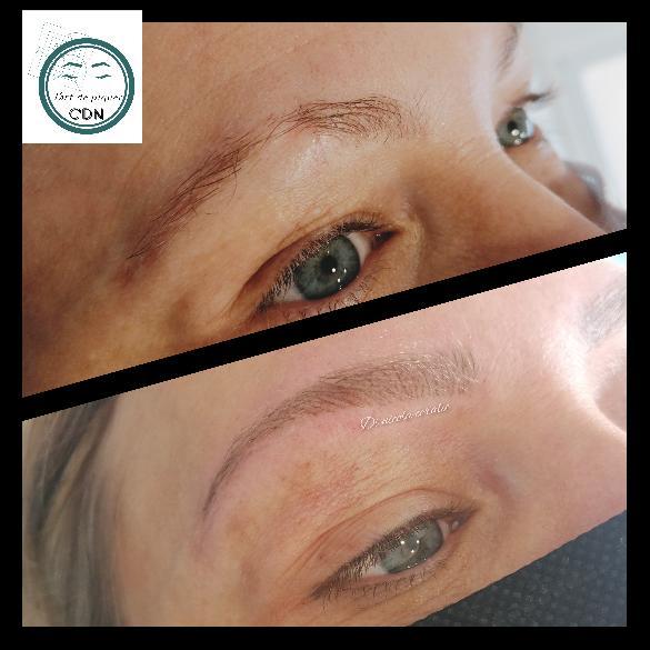 SOURCIL AVEC CICATRICE